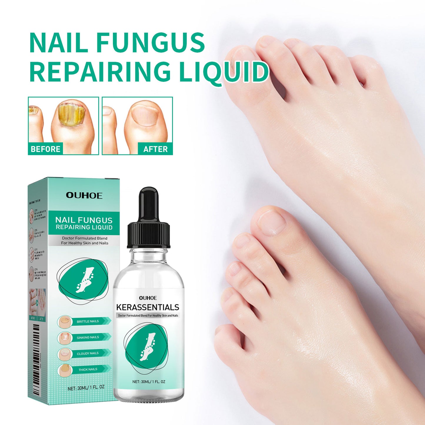 OUHOE Daily Nail Care Solution