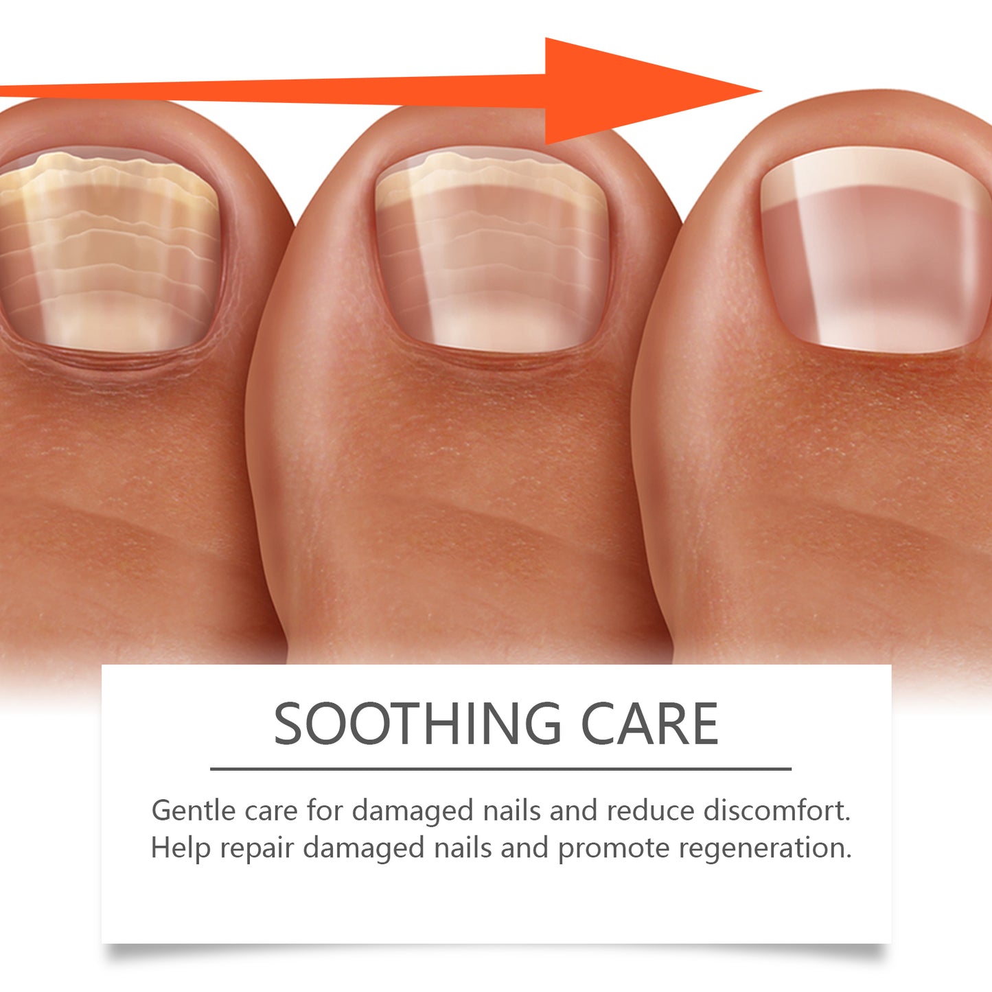 Herbal Nail Repair Solution