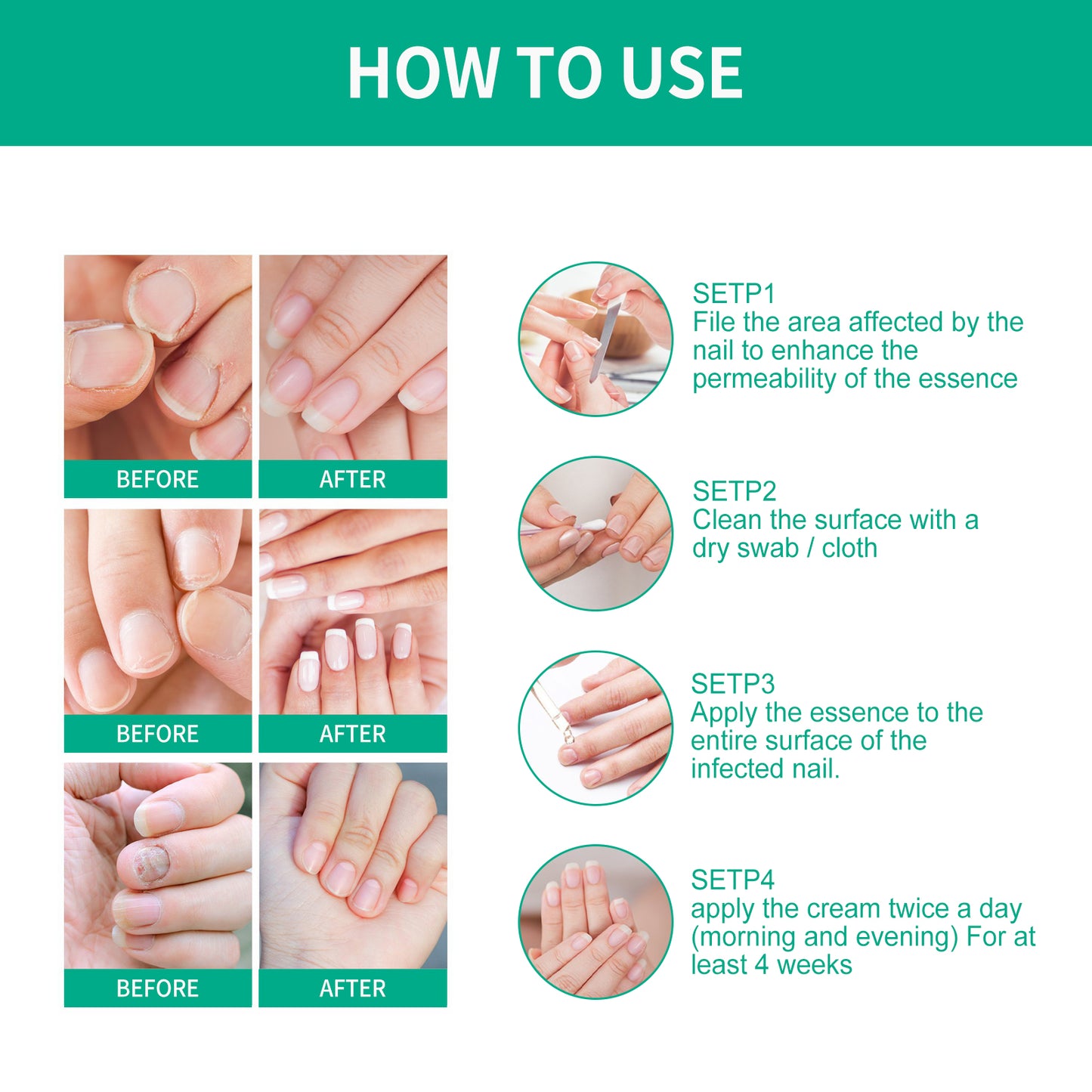 OUHOE Daily Nail Care Solution