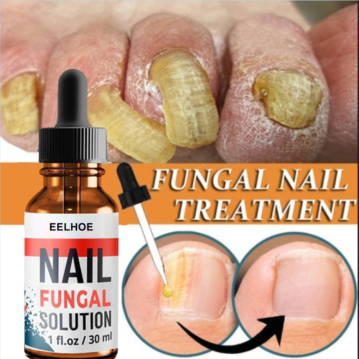 EELHOE Nail Repair Solution, Hand And Foot Gray Nail Care Repair Gray Nail Solution Thickening Soft Nails
