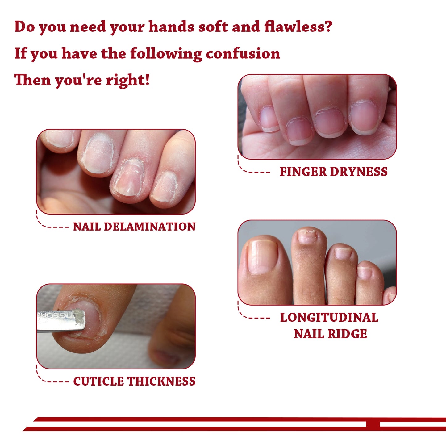 OUHOE Cuticle Moisturizing Oil