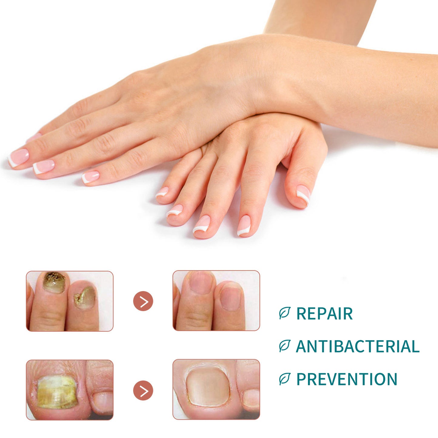 Brightening Nail Repair Patch