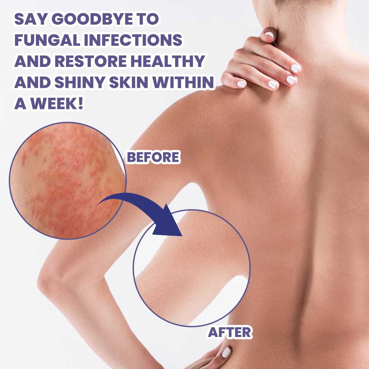 3-Day Anti-Fungal Barrier Repair Cream - Soothe Redness & Restore Skin Health