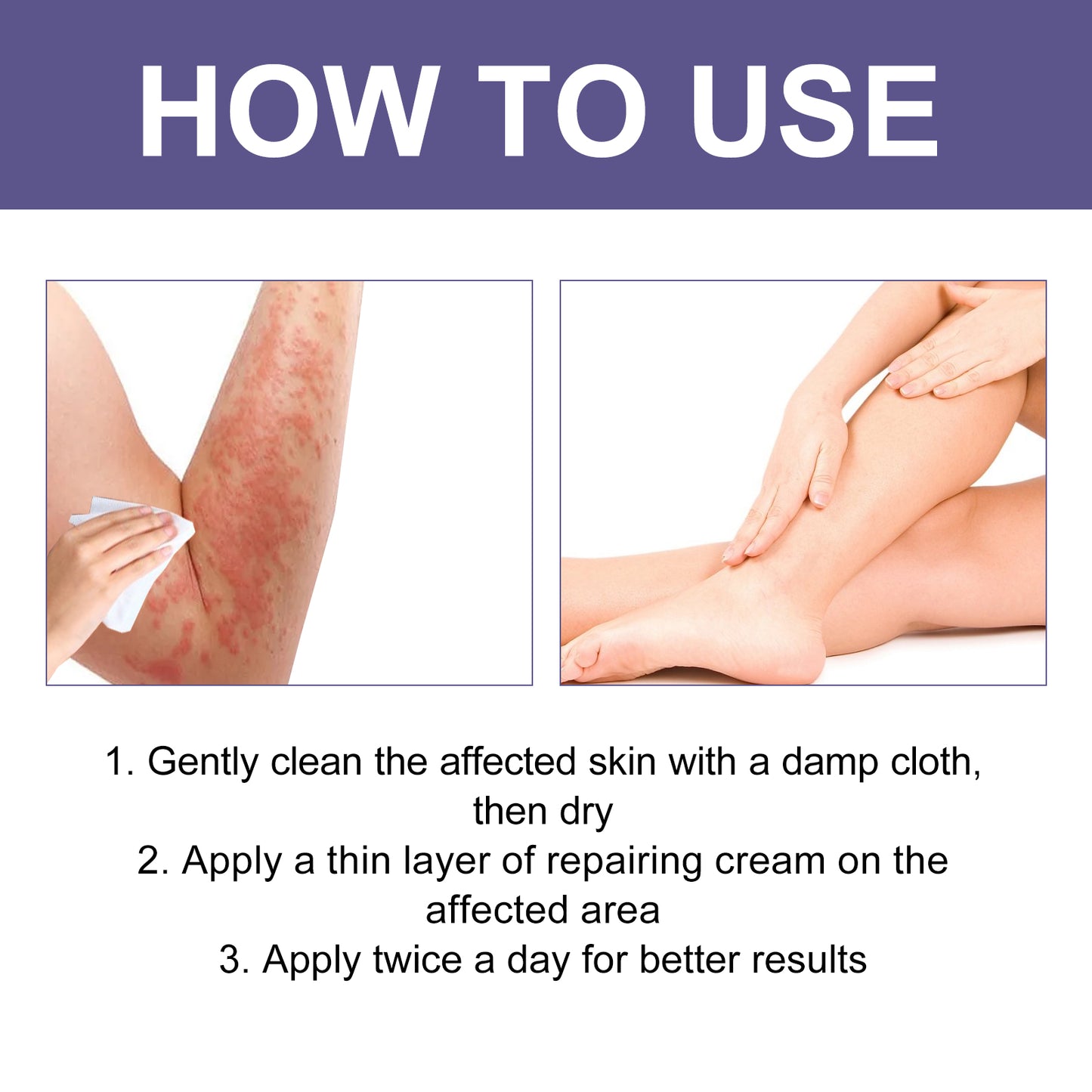 3-Day Anti-Fungal Barrier Repair Cream - Soothe Redness & Restore Skin Health