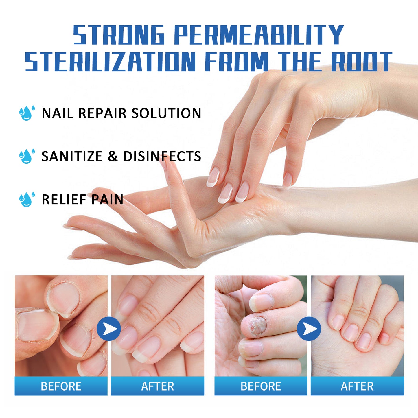 Nail Fungus Treatment Method, Repair Grey Nail Brightening Nail Thickening Nail Hand And Foot Nails Moisturizing Care Cream