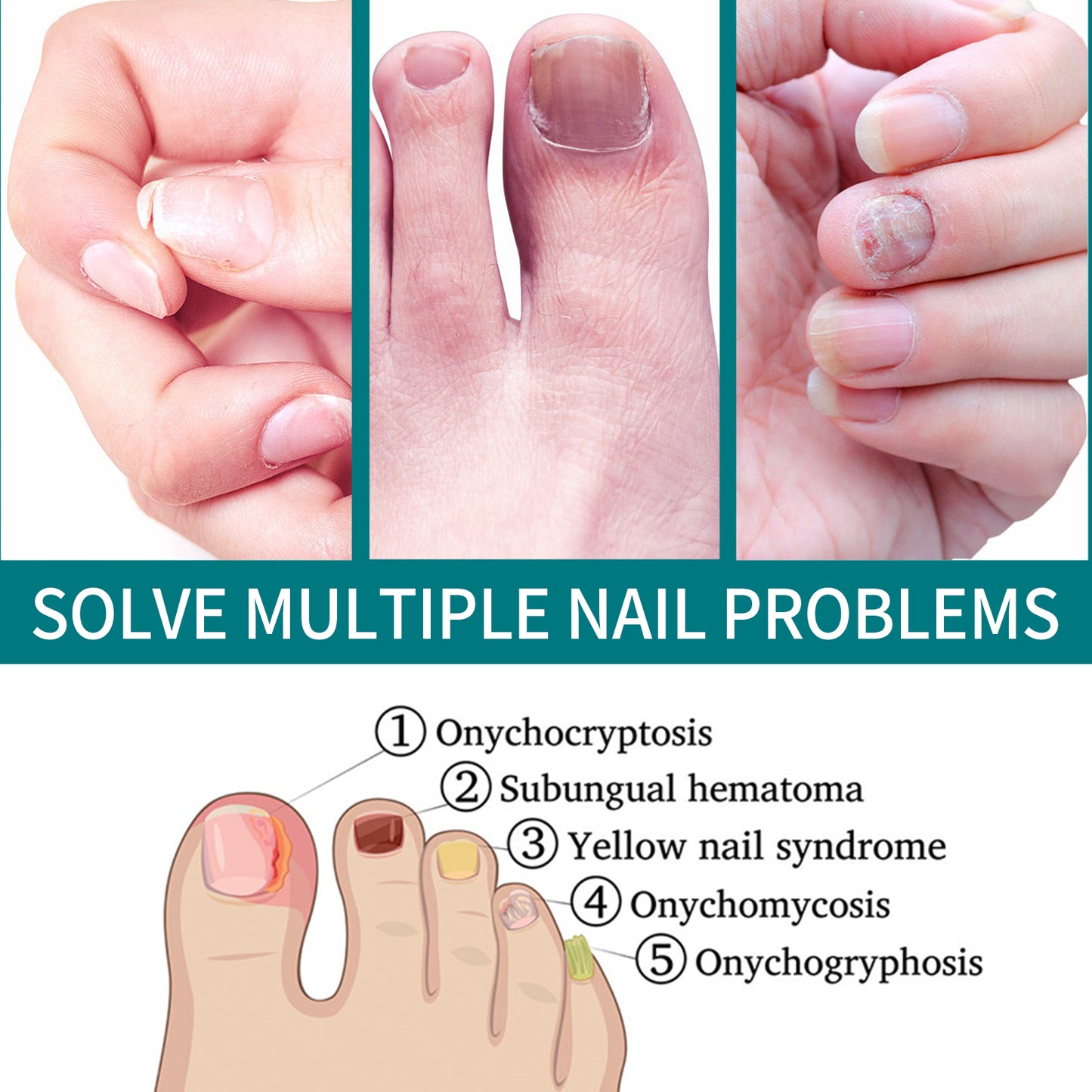 Brightening Nail Repair Patch