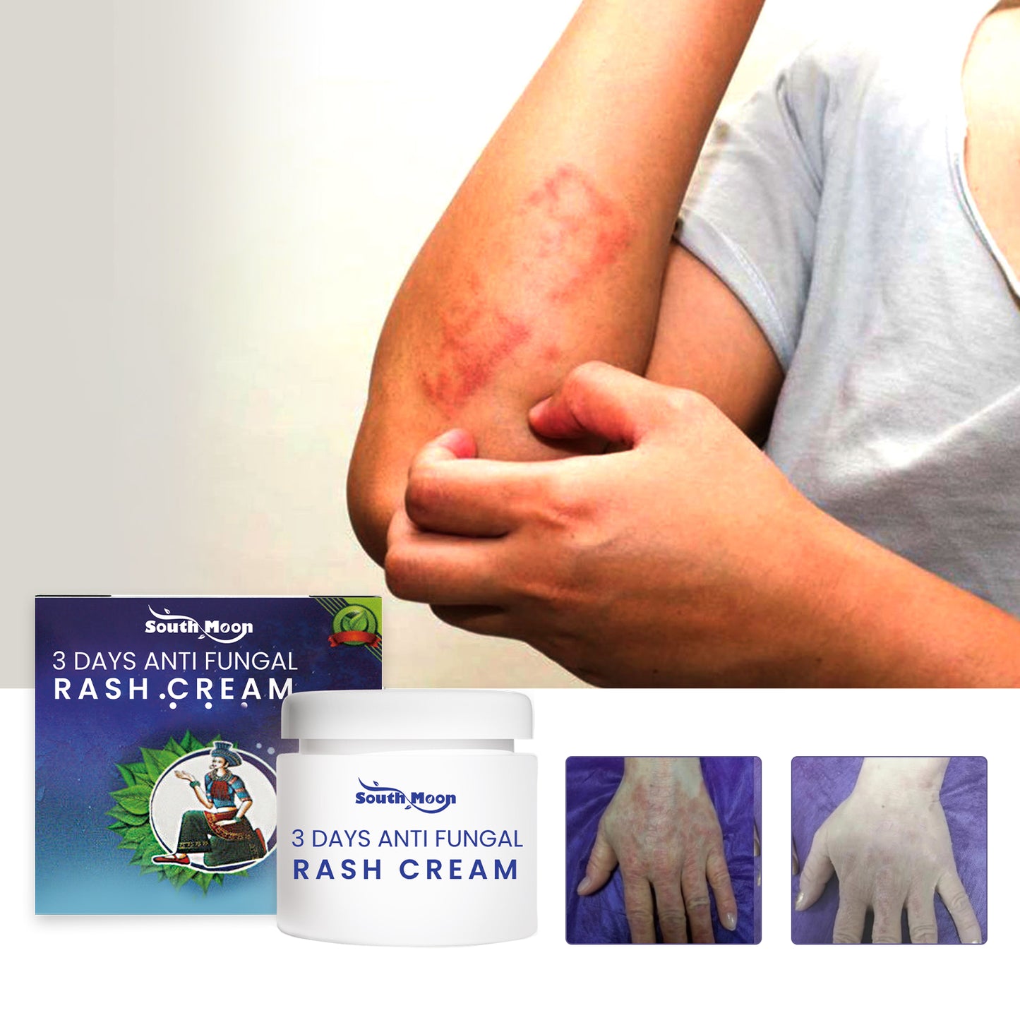 3-Day Anti-Fungal Barrier Repair Cream - Soothe Redness & Restore Skin Health